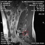 Https-fbcdn-profile-a-akamaihd-net-hprofile-ak-snc4-157147_681734781_63541144_n-jpg